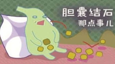 什么是膽囊結(jié)石？